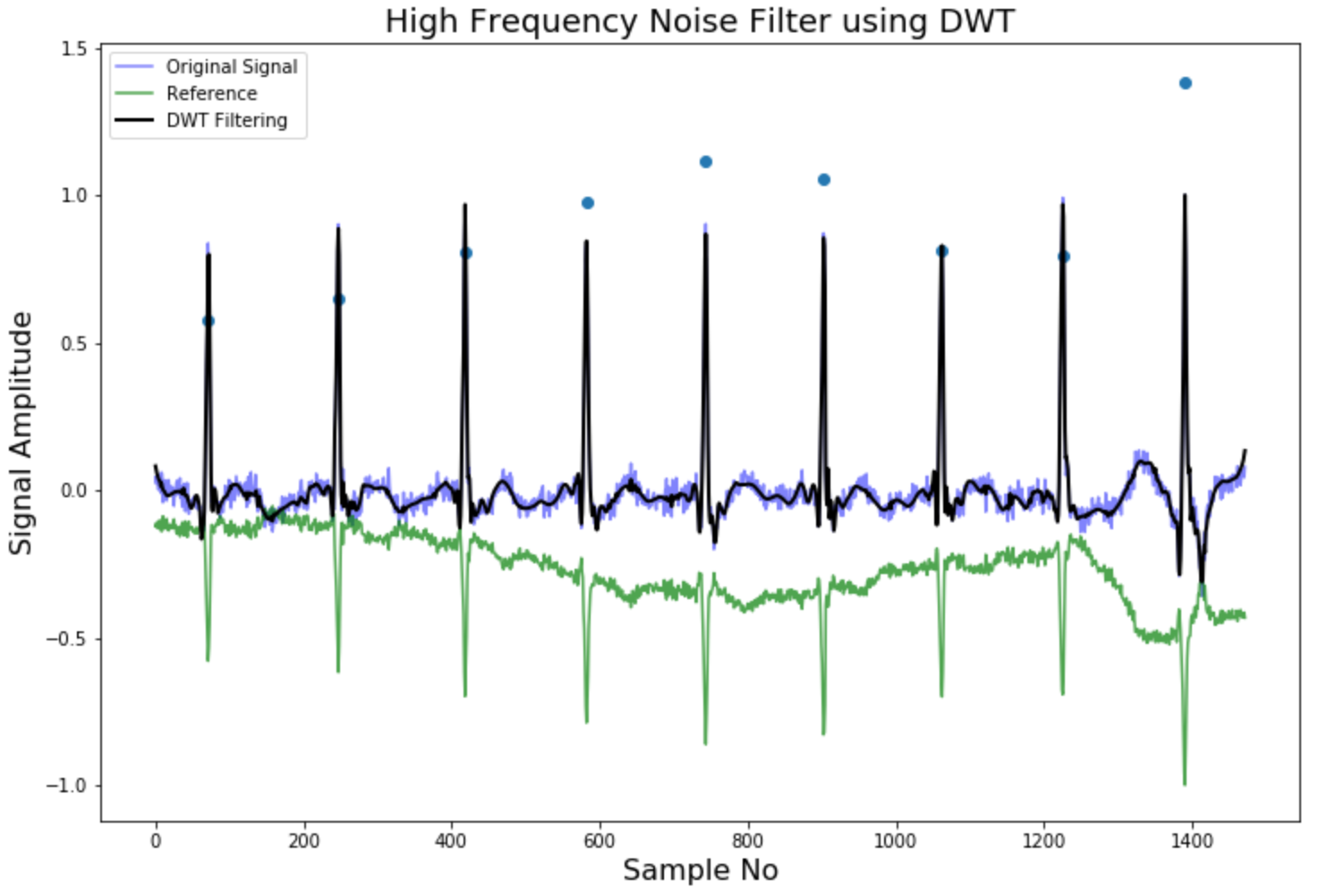ECG Denoising Pipeline